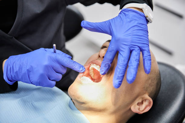 Best Emergency Care for Gum Disease in Westport, NC
